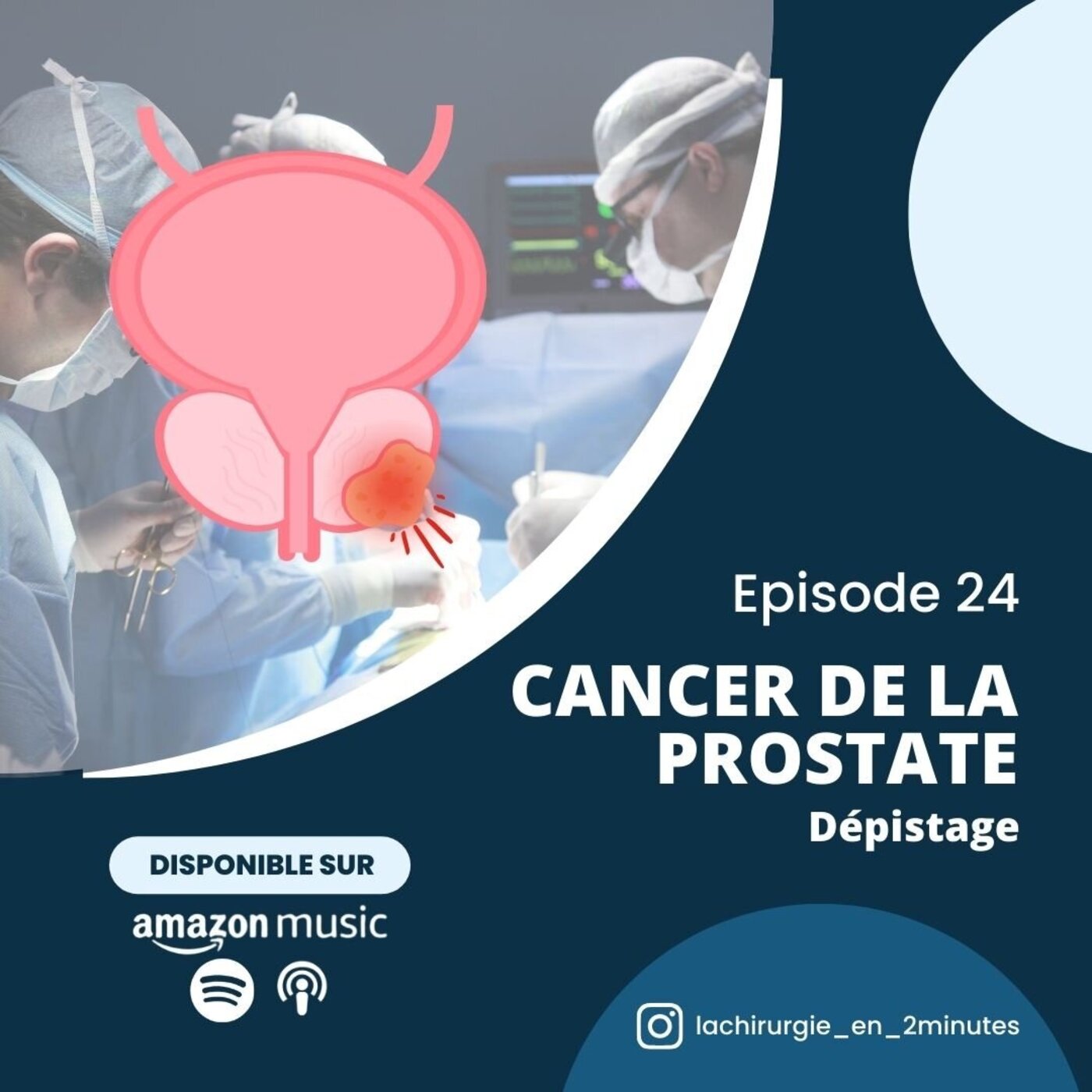 La chirurgie en 2 minutes
