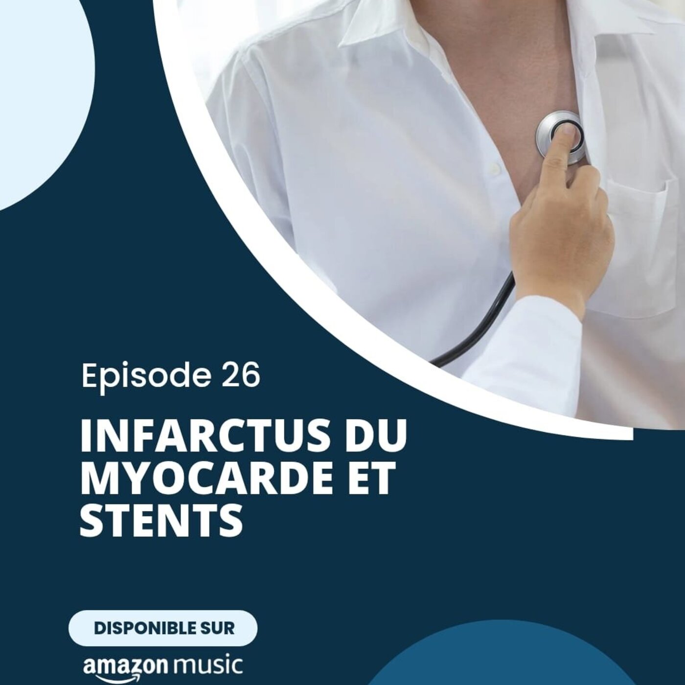 Infarctus du myocarde et stents