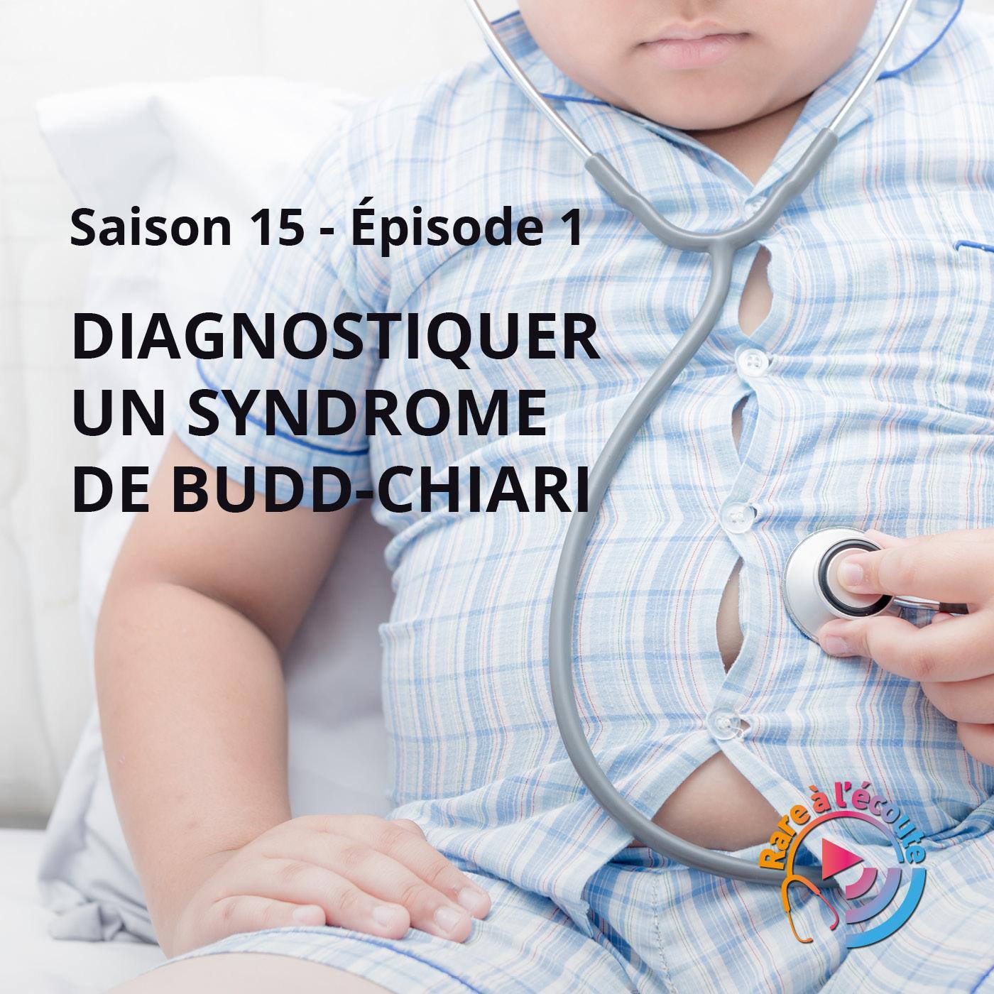 RARE à l\'écoute