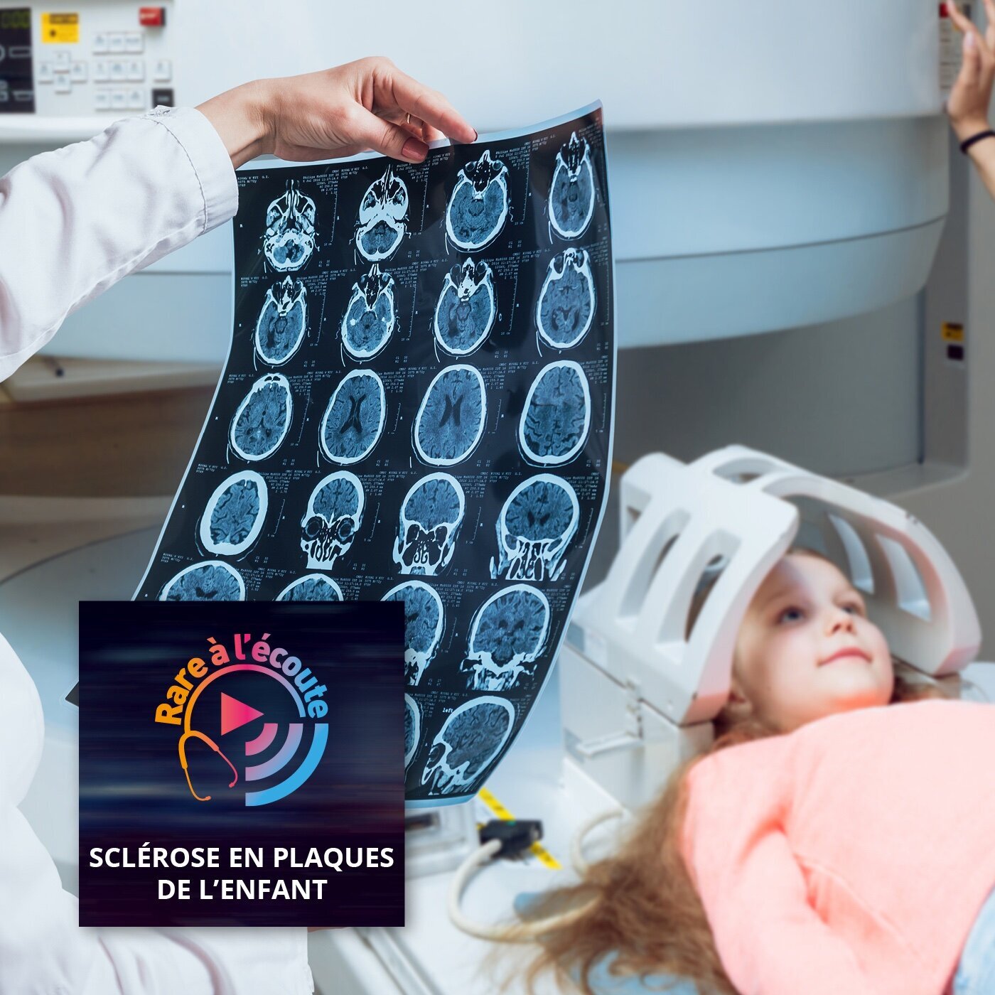Maladie rare – Diagnostiquer une sclérose en plaques de l'enfant