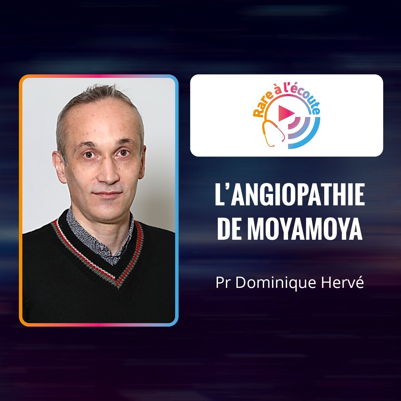 Maladie rare - L'angiopathie de Moyamoya Maladie rare - L'angiopathie de Moyamoya