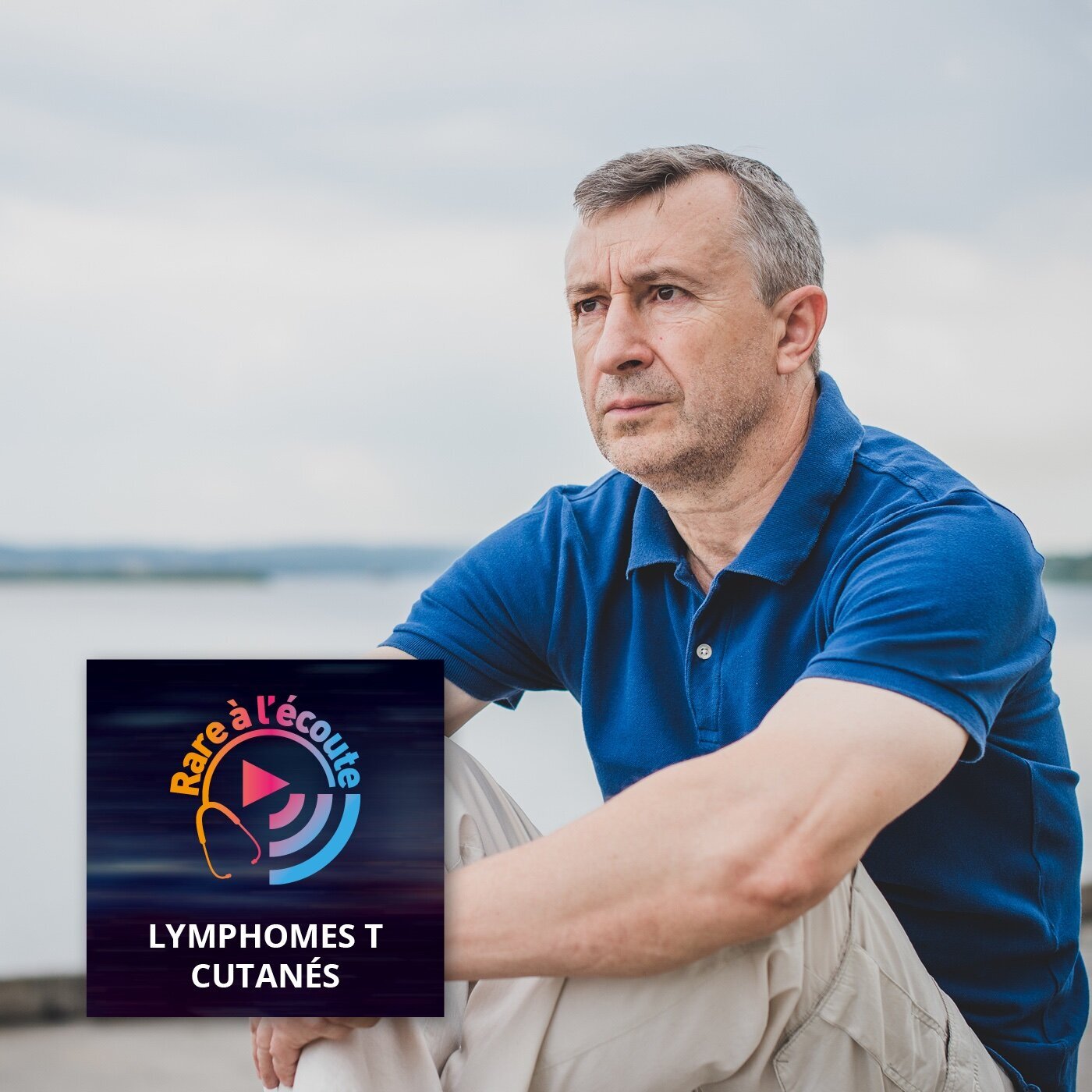 Maladie rare – Qu'appelle-t-on mycosis fongoïde ? Maladie rare – Qu'appelle-t-on mycosis fongoïde ?