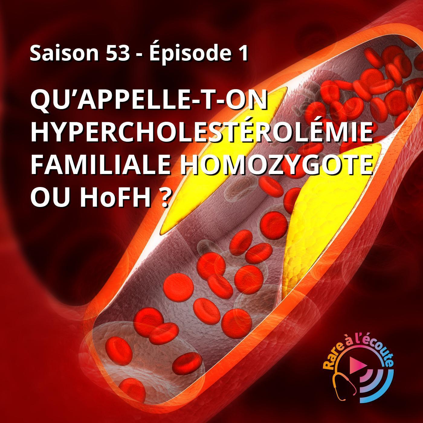 RARE à l\'écoute
