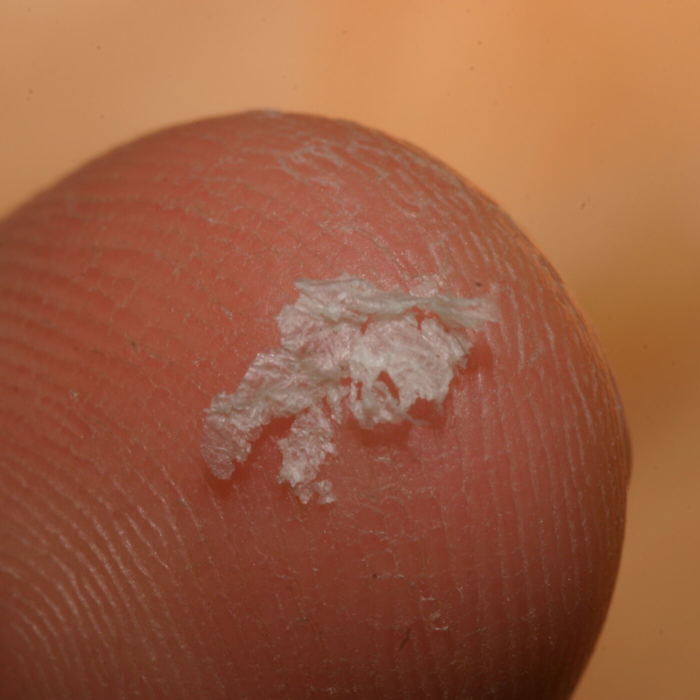 Understanding Skin Problems in Golden Retrievers