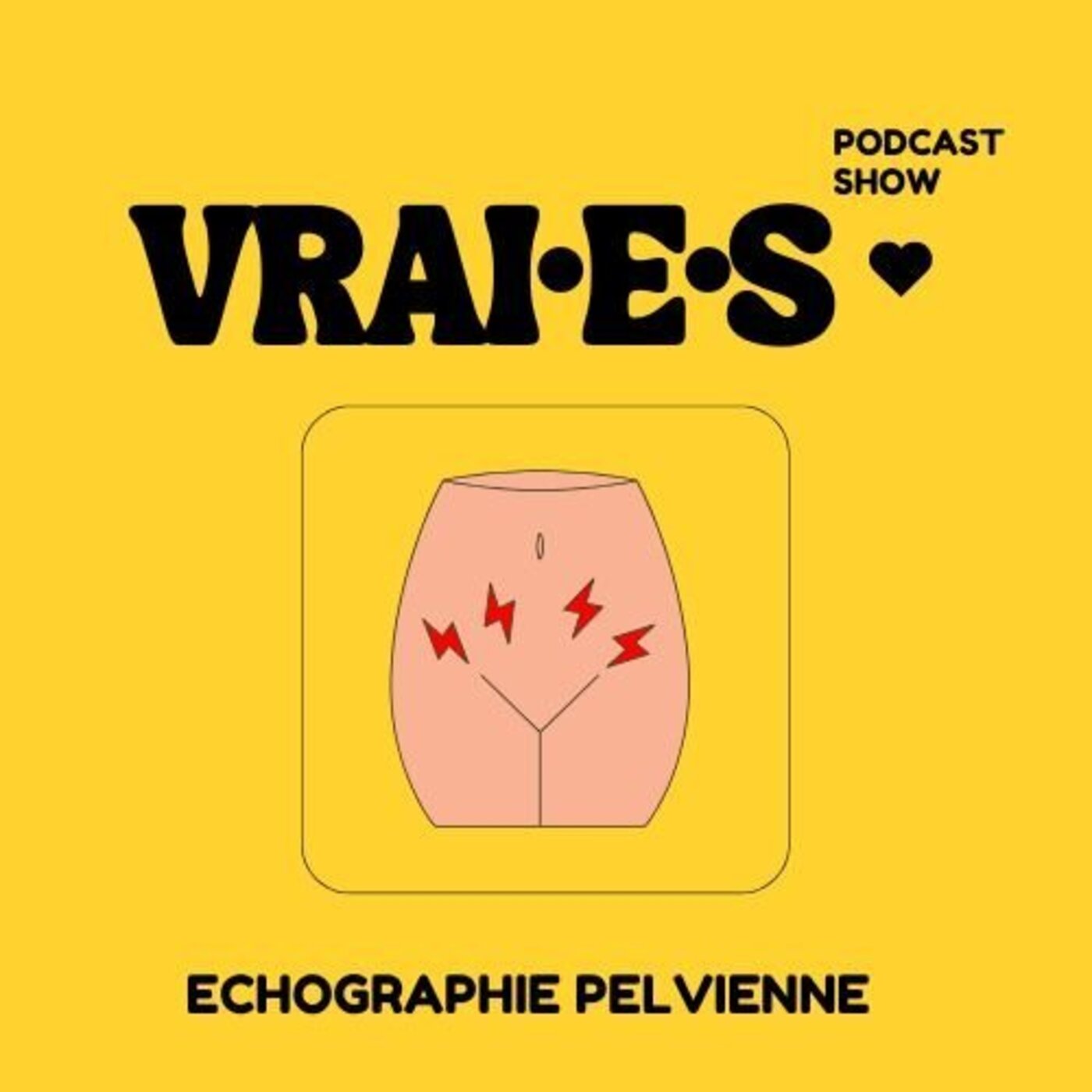 T'as déjà fait ou assisté à une échographie pelvienne? T'as déjà fait ou assisté à une échographie pelvienne?